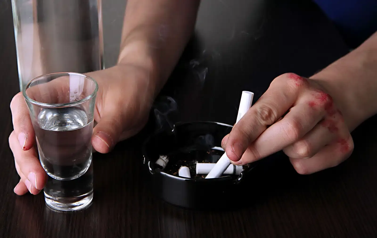 Dependencia Alcohol y Tabaco